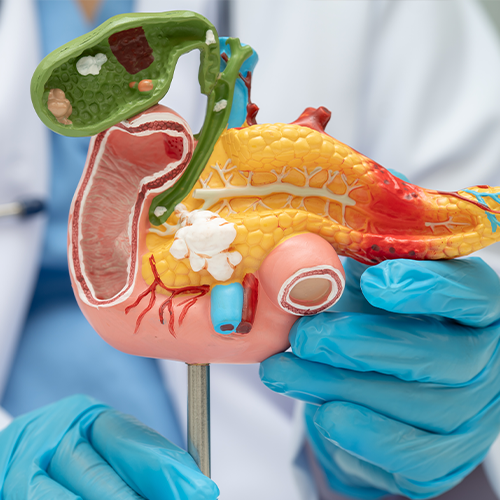20260408_smn_blog_science_innovation_pancreatic_cancer_newsletter